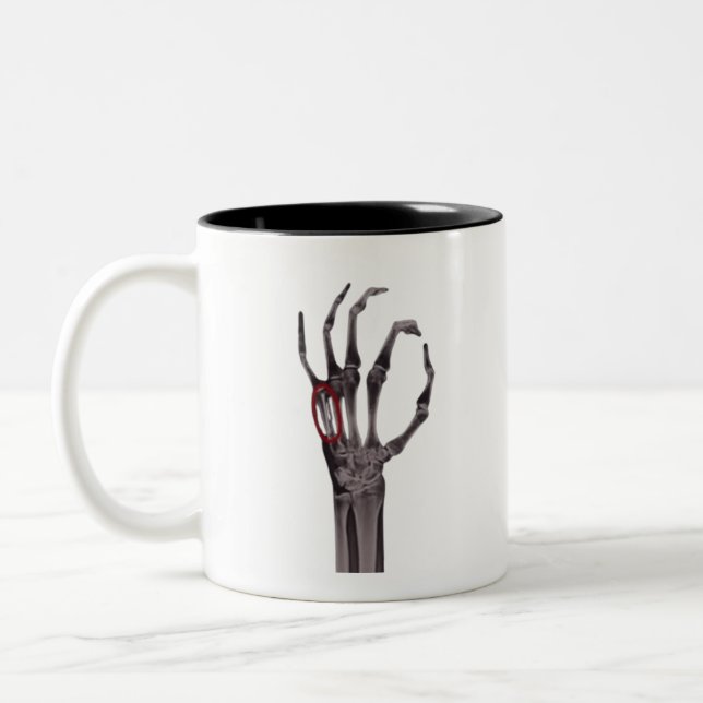 Knochen-Hände Skelett X-RAY-T - Shirt Zweifarbige Tasse (Links)