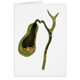 Konzeptbild von Gallstones im Gall