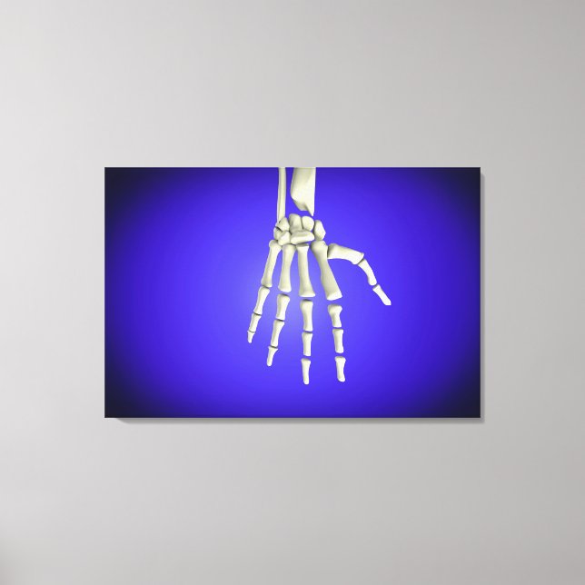 Konzeptuelles Bild der Knochen in der menschlichen Leinwanddruck (Vorderseite)