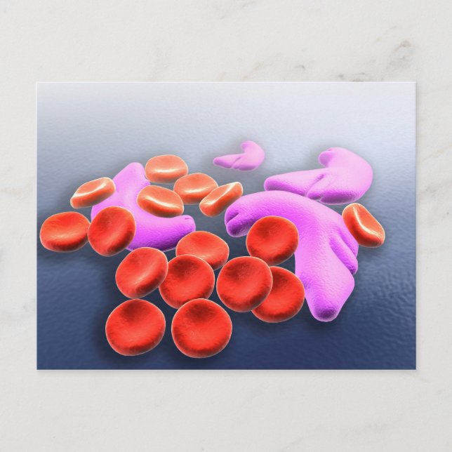Konzeptuelles Bild der Sichelzellanämie Postkarte (Vorderseite)