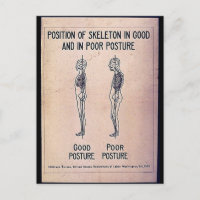 Lage des Skeletts in guter und schlechter Haltung