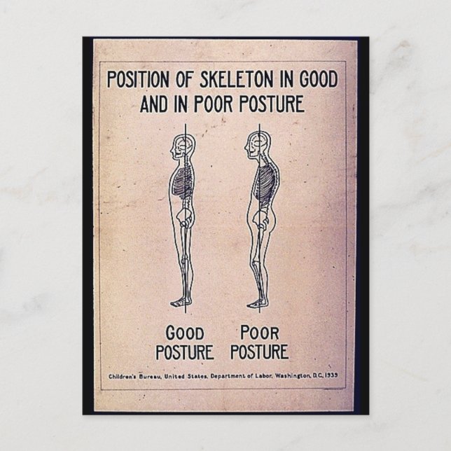 Lage des Skeletts in guter und schlechter Haltung Postkarte (Vorderseite)