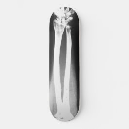 Le skateboard Breaks de Bradley Boness
