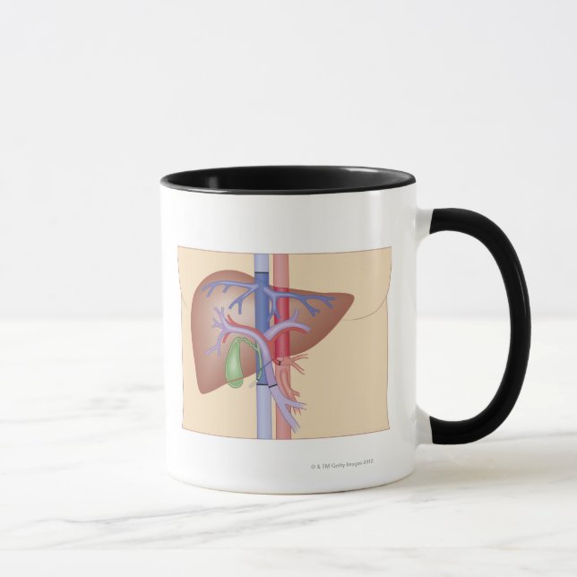 Leber-Transplantations-Verfahren Tasse (Rechts)