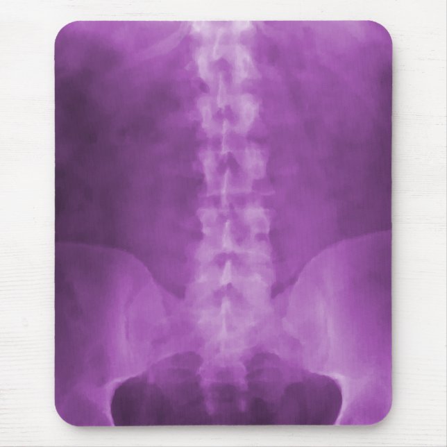 Lila Digital-Röntgenstrahl-Kunst Mousepad (Vorne)