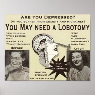 Lobotomie-Werbeplakat | Vintage Ad | Poster