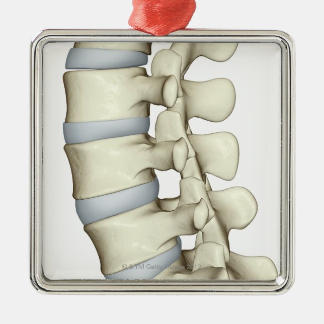 Lumbale Wirbel Ornament Aus Metall (Vorne)