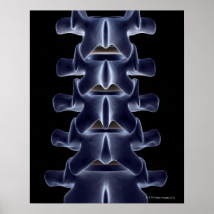 Lumbaler Wirbel 2 Poster