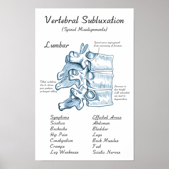 Lumbar Subluxation Chiropractic Art Poster (Vorne)