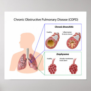 Lungenerkrankung (COPD) Poster