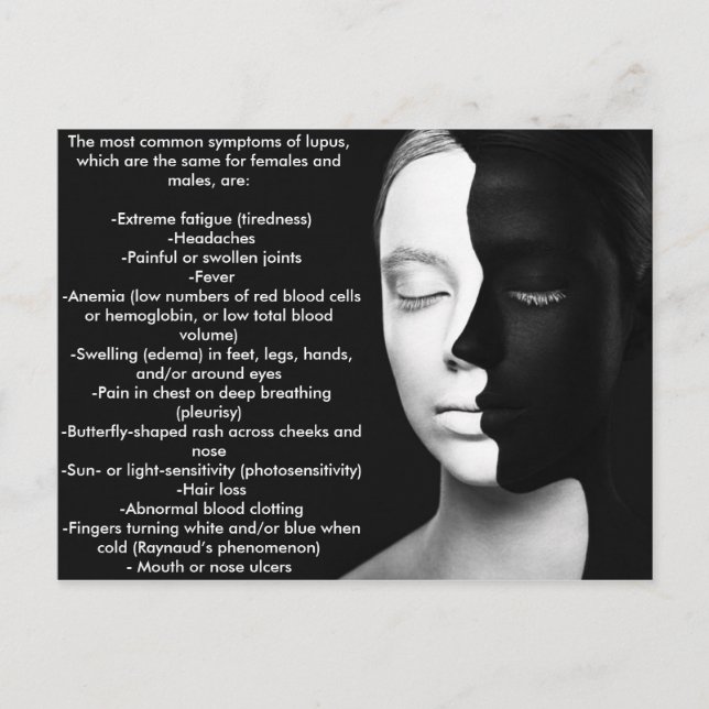 Lupus der stille Partner... Postkarte (Vorderseite)