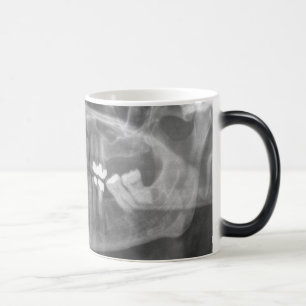 Magic Gros sourire Morpher Mug