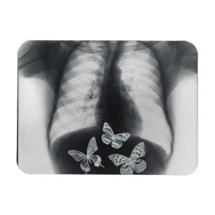Magnet Flexible Rayon X des papillons dans l'estomac
