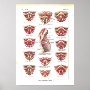 Maladies de Larynx Poster Anatomie Français