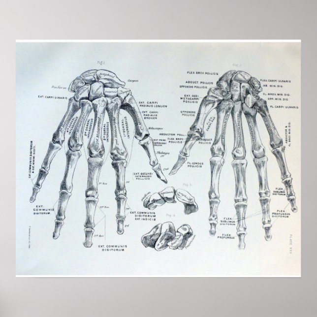 Medizinische Darstellung der Knochen der Hand Poster (Vorne)