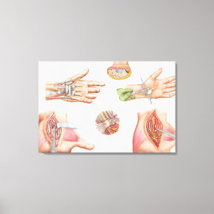 Medizinische Illustration, die Carpal-Tunnel zeigt Leinwanddruck