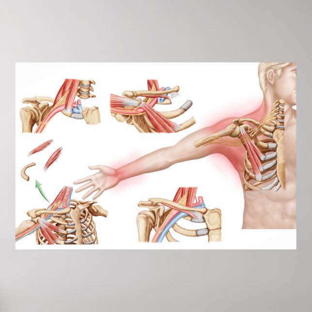 Medizinische Illustration im Detail Thorakische Ou Poster (Vorne)