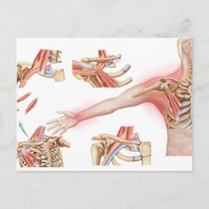 Medizinische Illustration im Detail Thorakische Ou Postkarte
