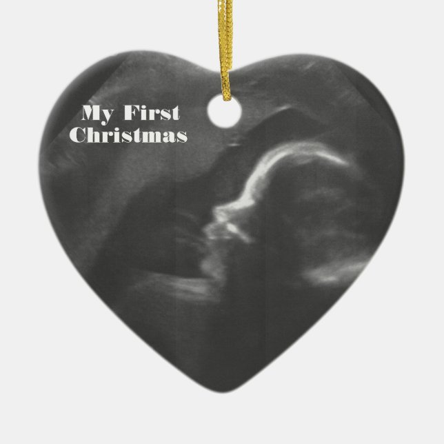 Mein erstes Weihnachtskundengerechter Baby-Scan Keramikornament (Vorne)