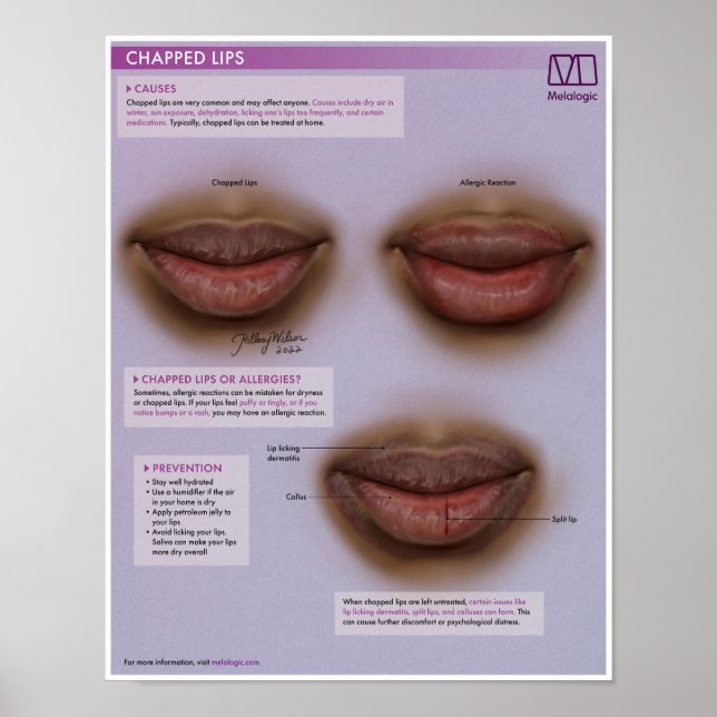 Melalogic Chapped Lips Medical Poster (Vorne)