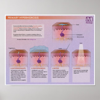 Melalogic Hyperhidrosis Medical Poster