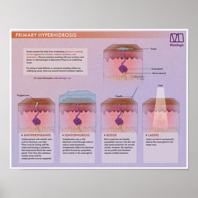 Melalogic Hyperhidrosis Medical Poster (Vorne)