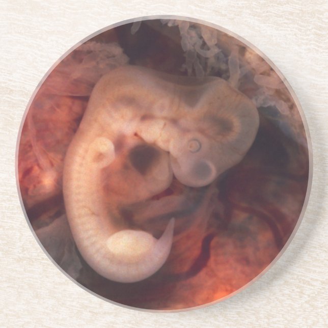 Menschlicher Embryo-7. Woche Schwangerschafts-5. Sandstein Untersetzer (Vorne)