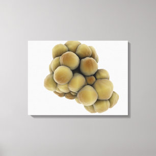 Mikroskopische Ansicht von Tumor 5 Leinwanddruck