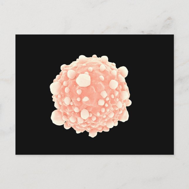 Mikroskopische Darstellung der Pankreaskrebszelle Postkarte (Vorderseite)