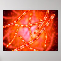 Mikroskopische Darstellung von Anthrax 1