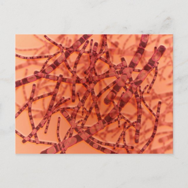 Mikroskopische Darstellung von Anthrax 3 Postkarte (Vorderseite)