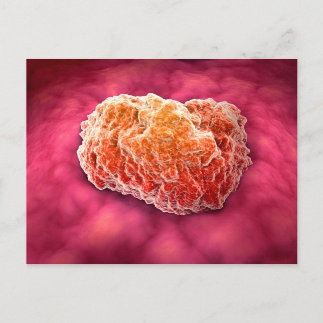 Mikroskopische Tumoransicht 3 Postkarte (Vorderseite)