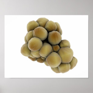 Mikroskopische Tumoransicht 5 Poster