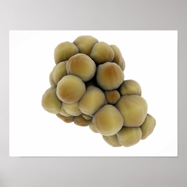 Mikroskopische Tumoransicht 5 Poster (Vorne)