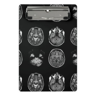 Mini Porte-bloc Analyse IRM du cerveau