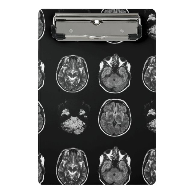 Mini Porte-bloc Analyse IRM du cerveau (Devant)
