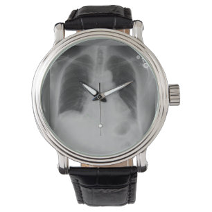 Montre de ~ de rayon du coffre X