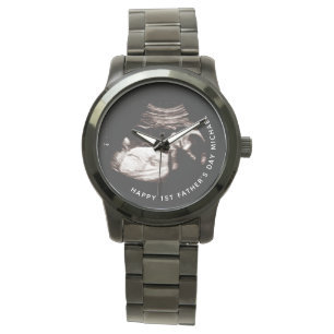 Montre Fête des pères Nom personnalisé Photo Bébé Sonogra