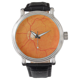 Montre Ophtalmologie Optométrie OEil Fundus Exposition S