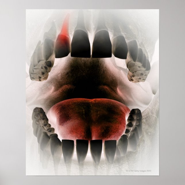 Mouth Poster (Vorne)