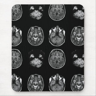 MRT des Gehirns Mousepad