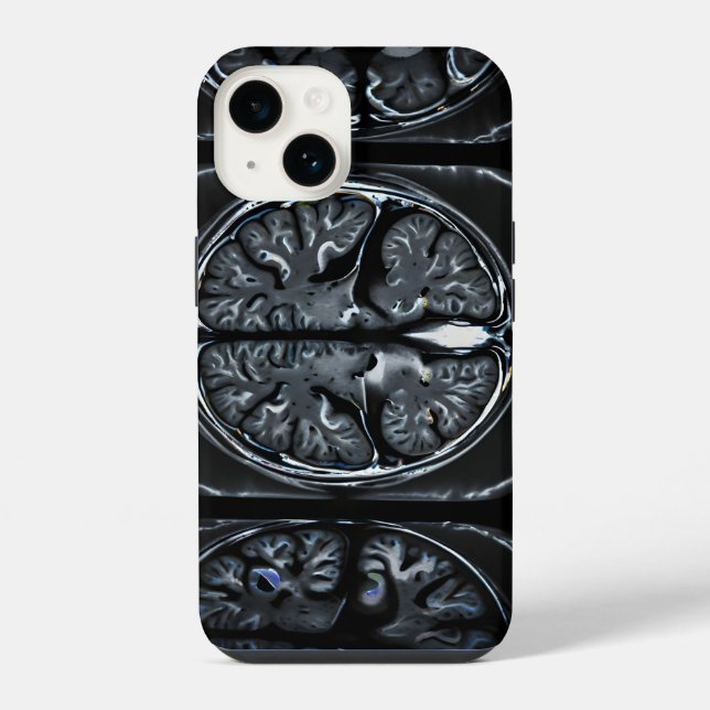 MRT-Gehirnscan iPhone 14 Hülle (Rückseite)