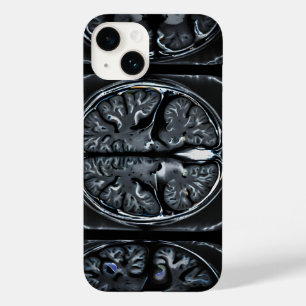 MRT-Gehirnuntersuchung Case-Mate iPhone 14 Hülle