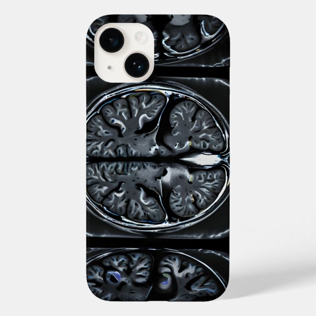 MRT-Gehirnuntersuchung Case-Mate iPhone 14 Hülle (Rückseite)