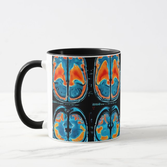 MRT-Gehirnuntersuchung Tasse (Links)