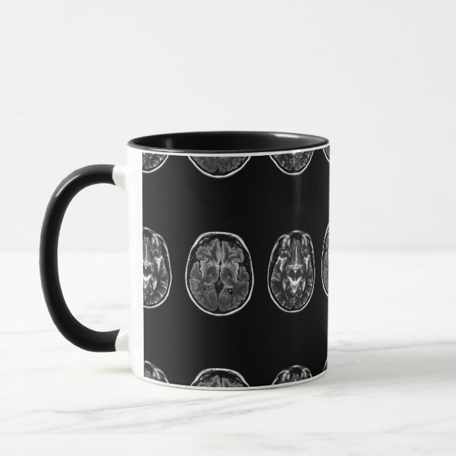 Mug Analyse Mri du cerveau (Gauche)