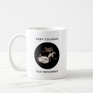 Mug Faire-part de grossesse Sonogramme bébé Photo