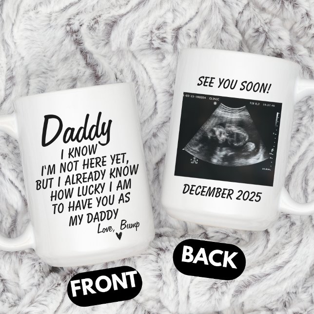 Mug Personalized Sonogram Photo, Ultrasound Photo Baby (Créateur téléchargé)