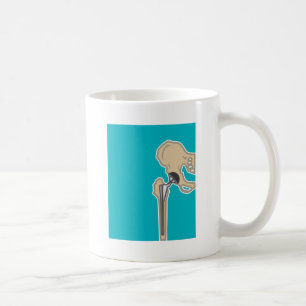 Mug Remplacement d'articulation de la hanche