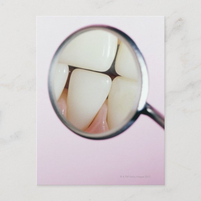 Nahe der Zähne, die im Zahnspiegel reflektiert wer Postkarte (Vorderseite)